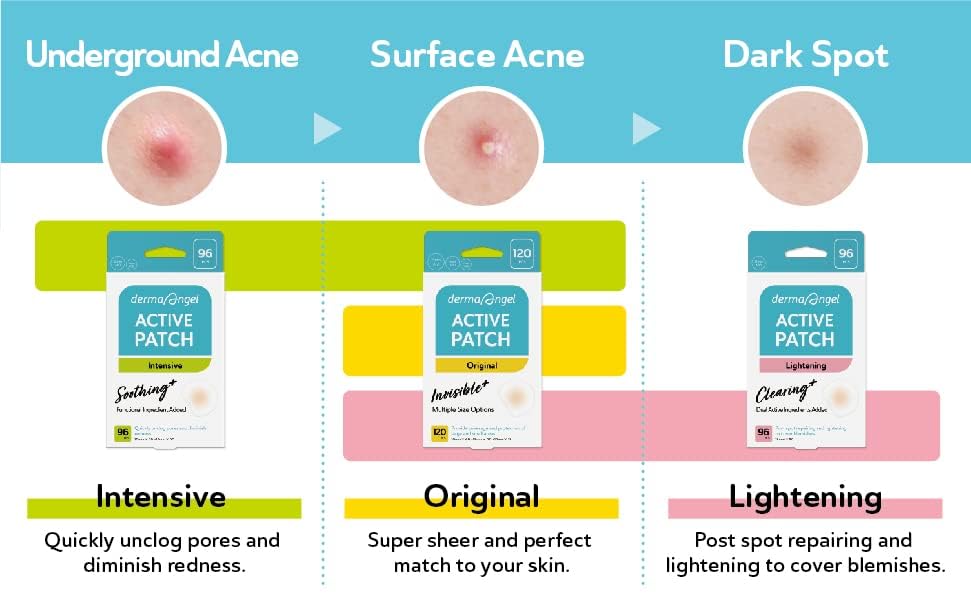DERMA ANGEL post-acne patches suggesting support for healing