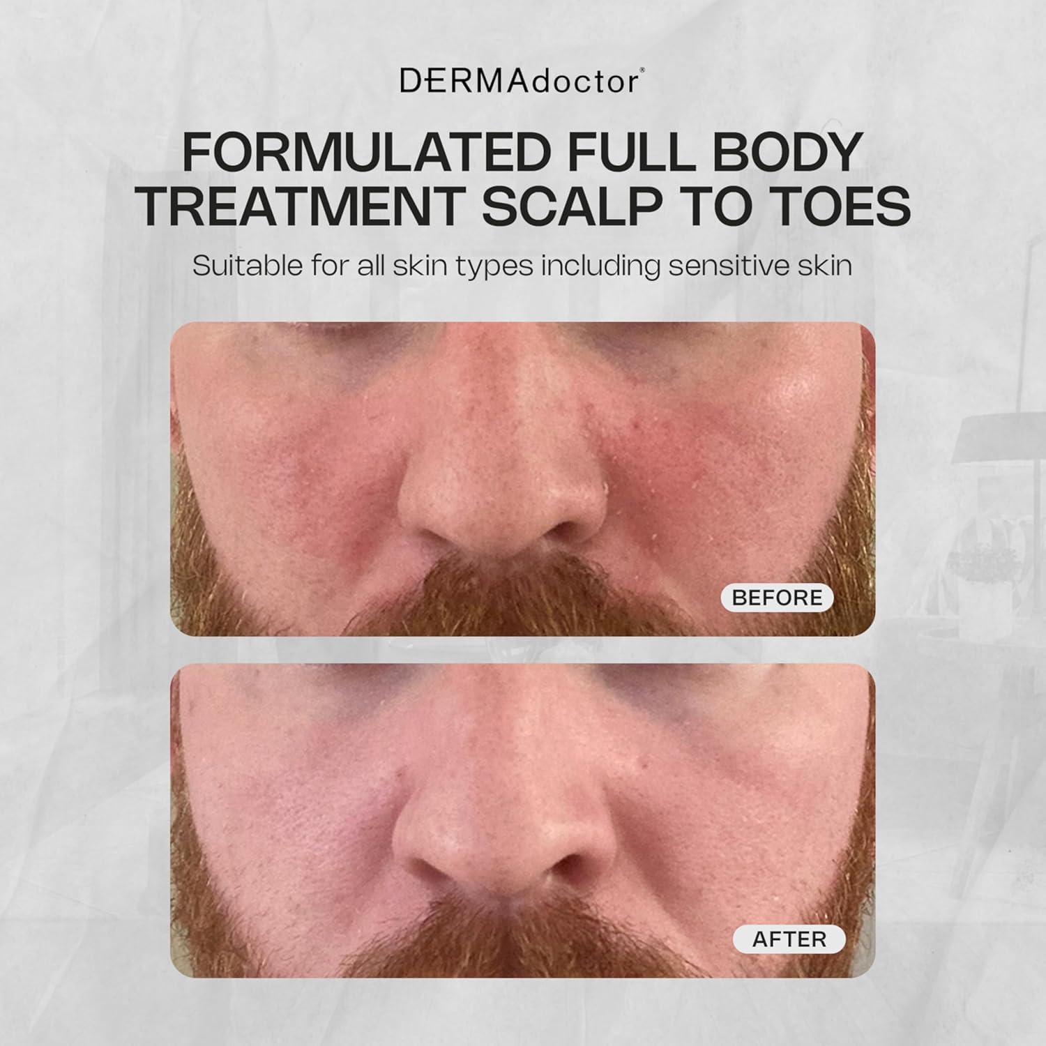 DERMAdoctor Seborrheic Dermatitis Face Wash rich lather cleanses face, body, and scalp with ease.