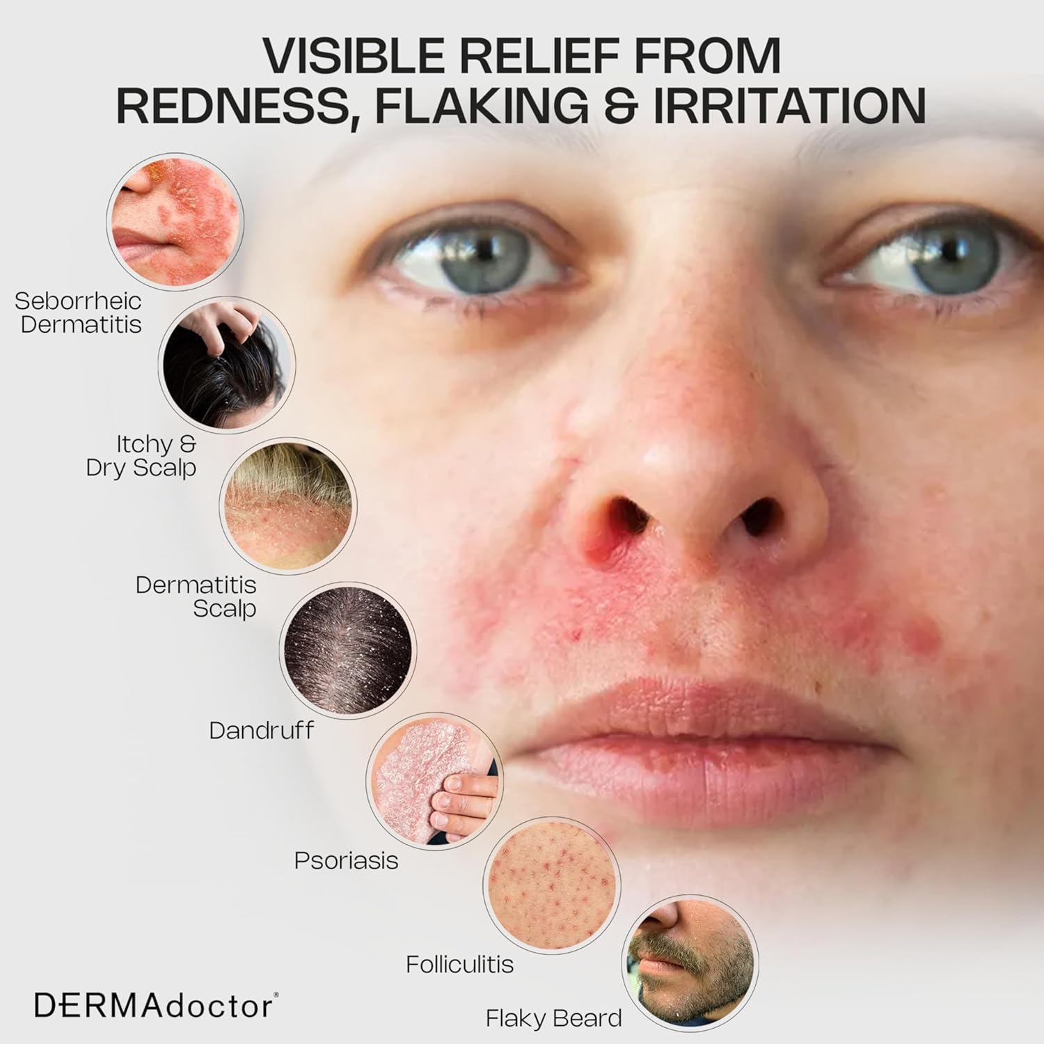 DERMAdoctor Seborrheic Dermatitis Face Wash scalp application demonstrates targeted cleansing.