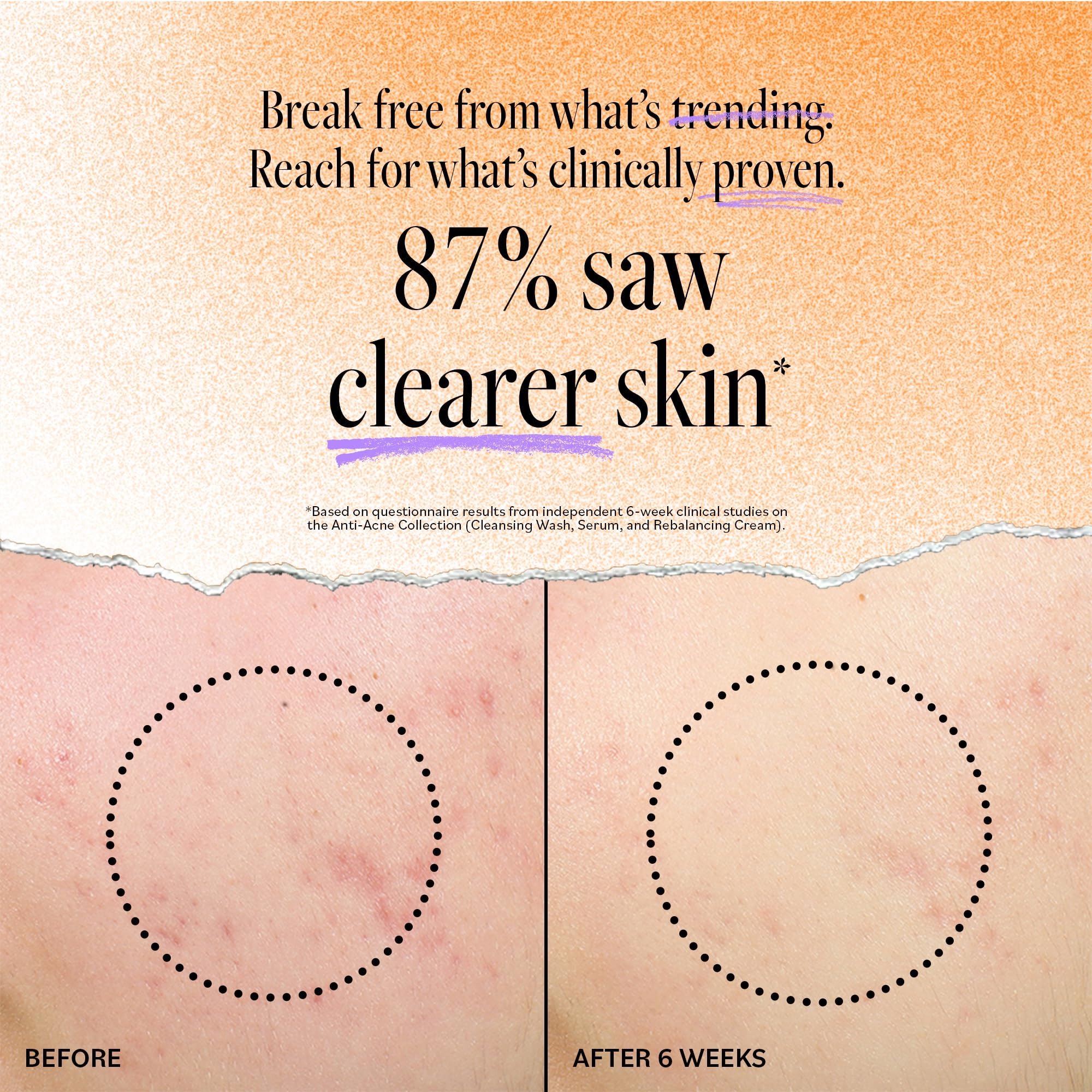 Derma E Tea Tree and Lavender oils ingredient close-up for blemish care.