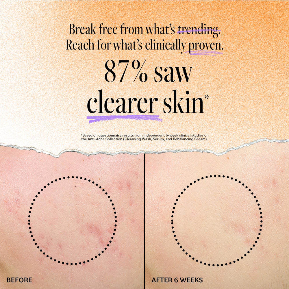 Derma E Tea Tree and Lavender oils ingredient close-up for blemish care.