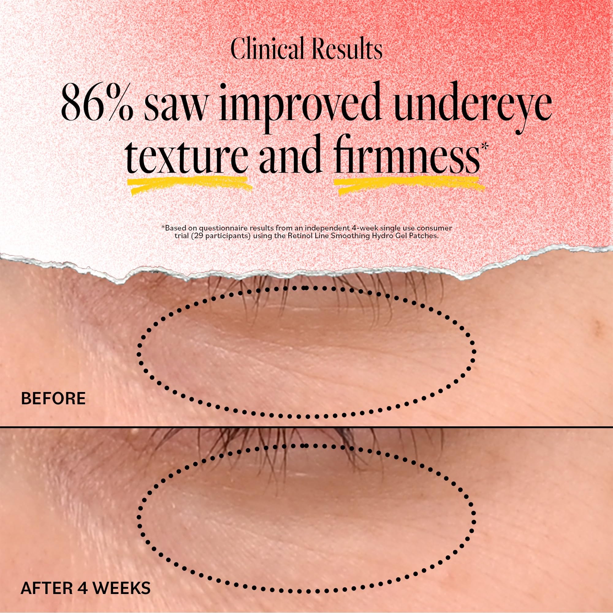 Derma E hydro gel patches texture close-up showing cooling hydration.