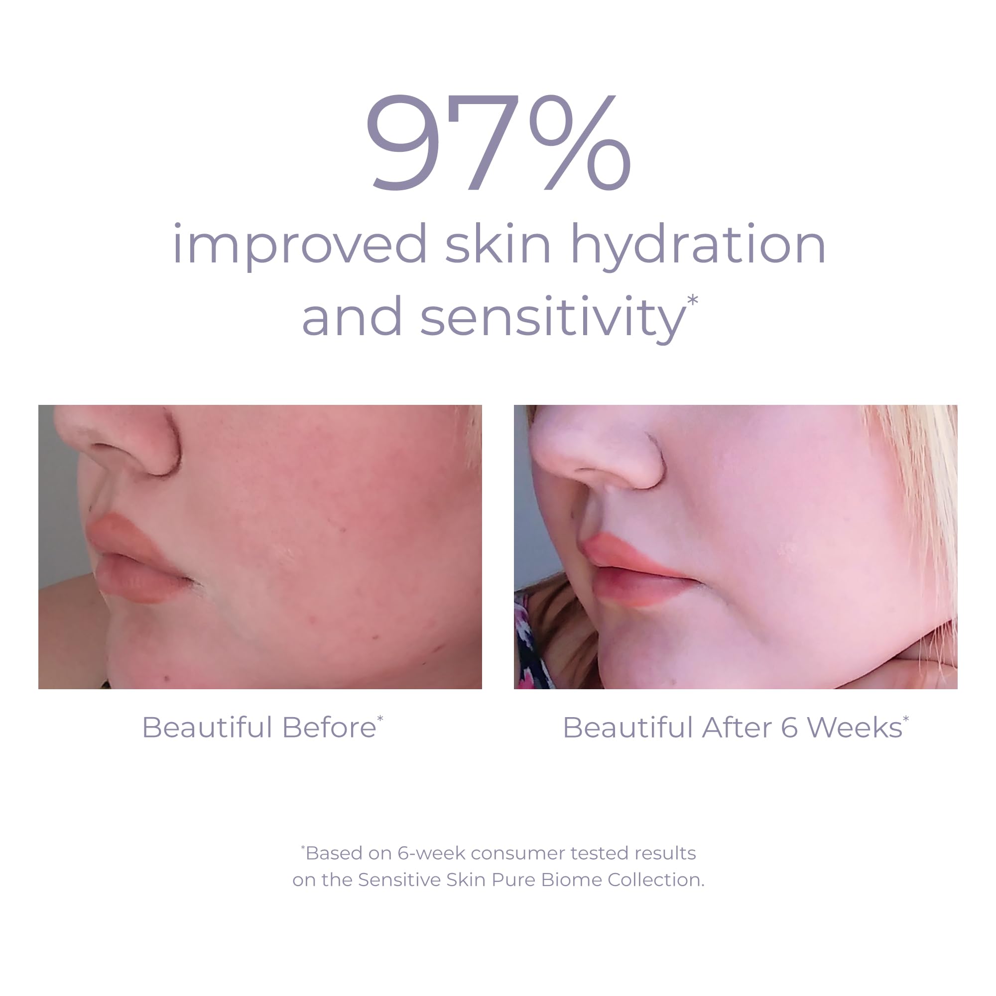Derma E Pure Biome Balancing Cream Vitamin E nourishment