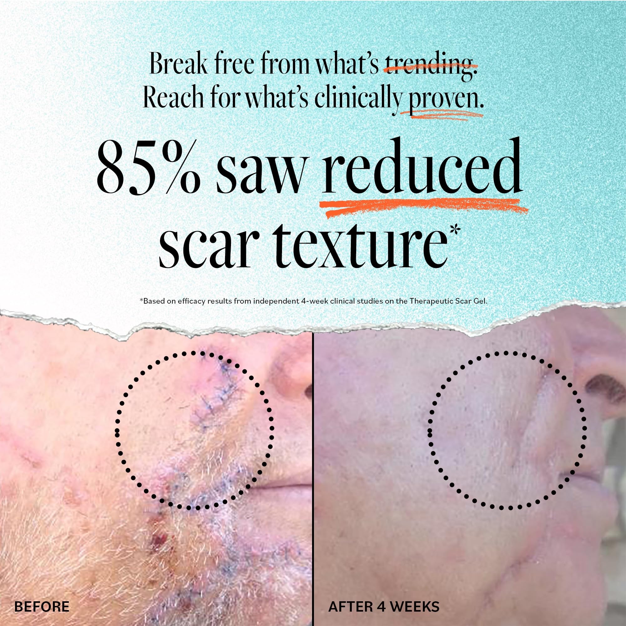 Derma E Scar Gel applied to tattoo scar areas for smoother skin