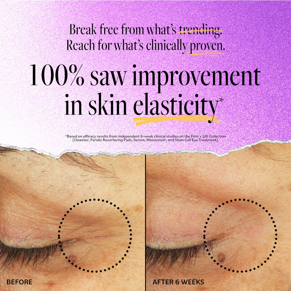 Derma E Stem Cell Lifting Eye Treatment upper eyelid area captured during gentle patting for firming feel.
