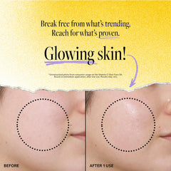 Turmeric in Derma E Glow Face Oil supports a revitalized, even-toned look
