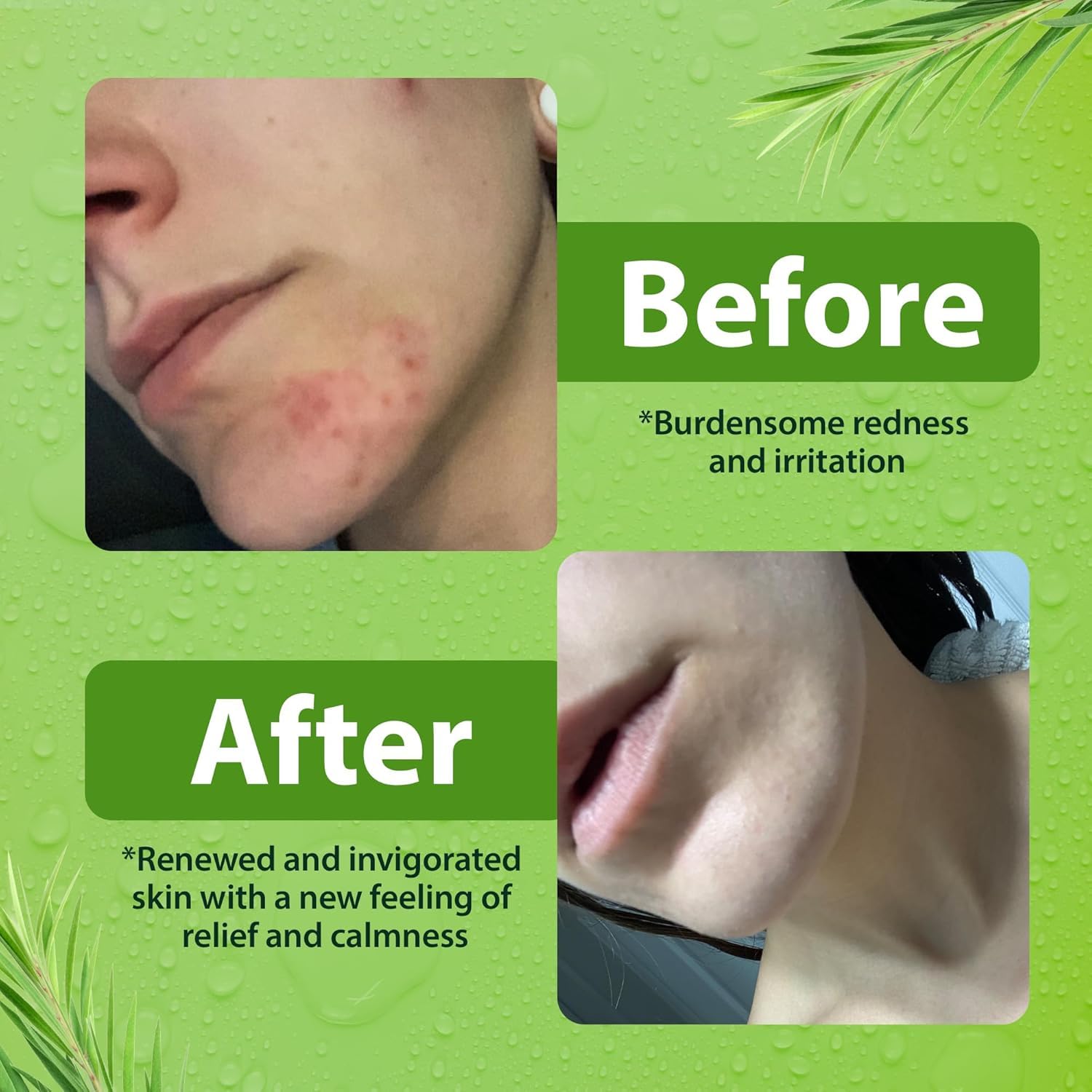 Derma-Nu body-odor-protection close-up illustrates all-day freshness against odor-causing bacteria.