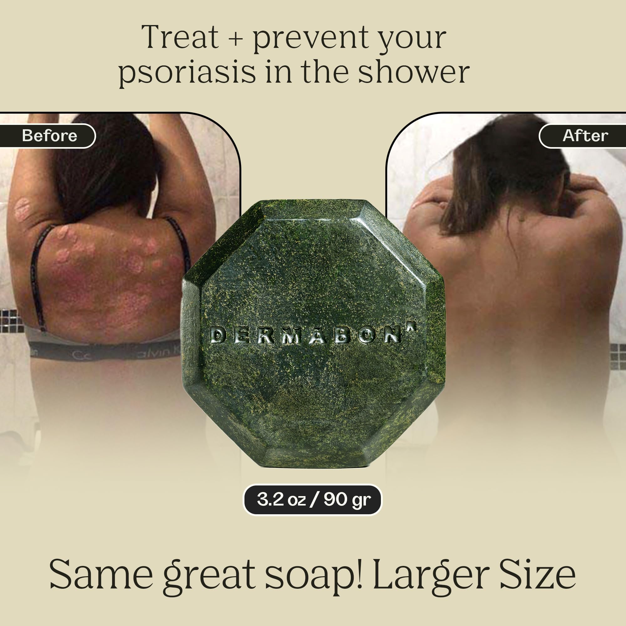Dermabon coal tar soap bar with label highlights 2% coal tar