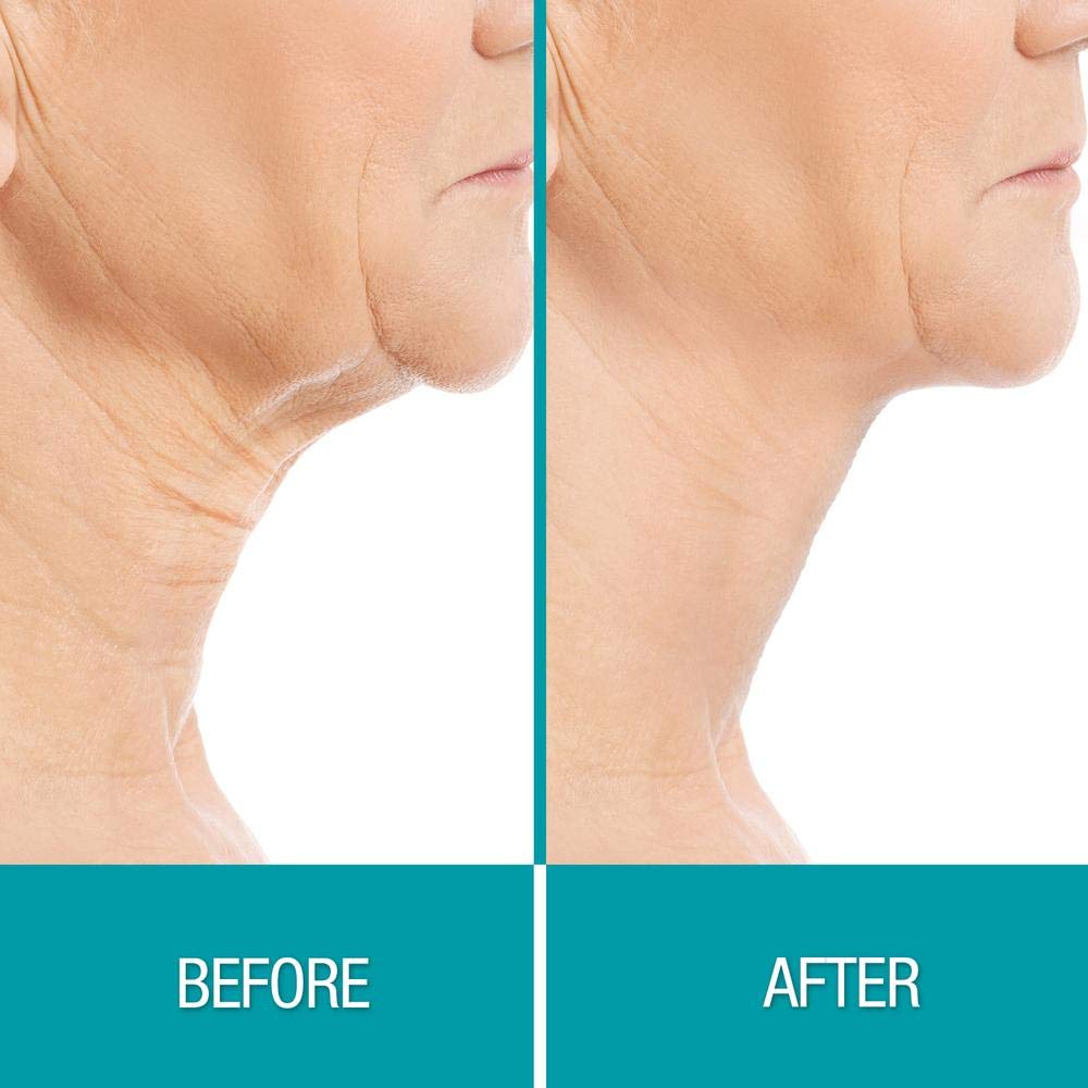 Dermactin Crepe Be Gone ingredients blend highlighting hydration and elasticity support.