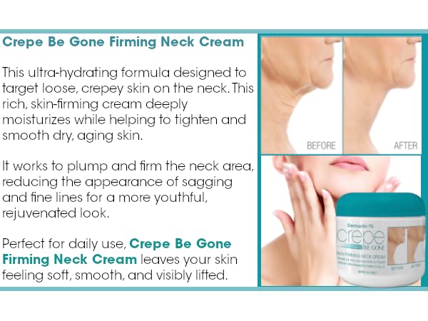 Neck and décolletage area treated with Dermactin Crepe Be Gone cream.