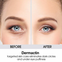 Dermactin eye cream puffiness close-up highlights cooling formula.