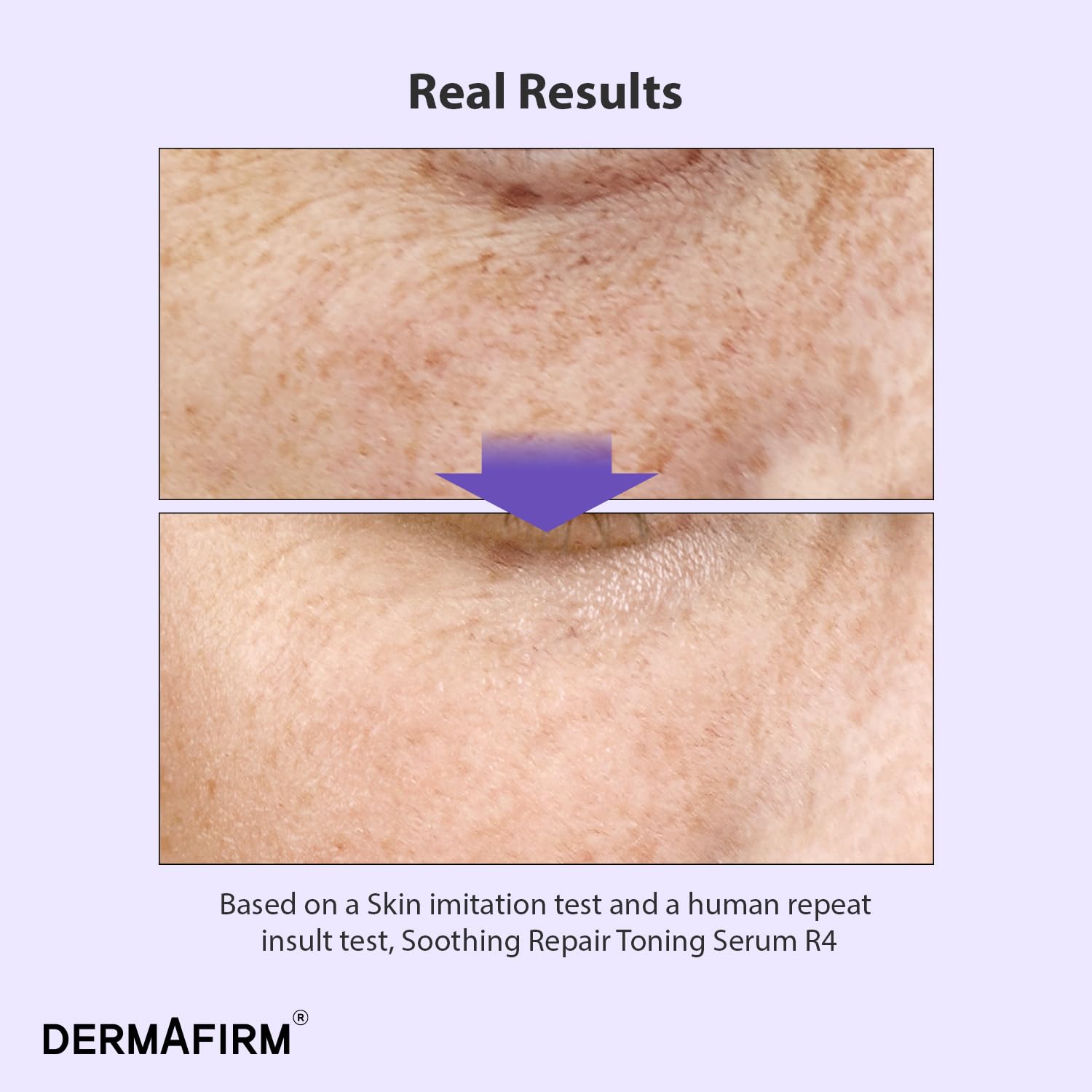 Dermafirm eucalyptus and Perilla leaf essence for soothing, balanced complexion