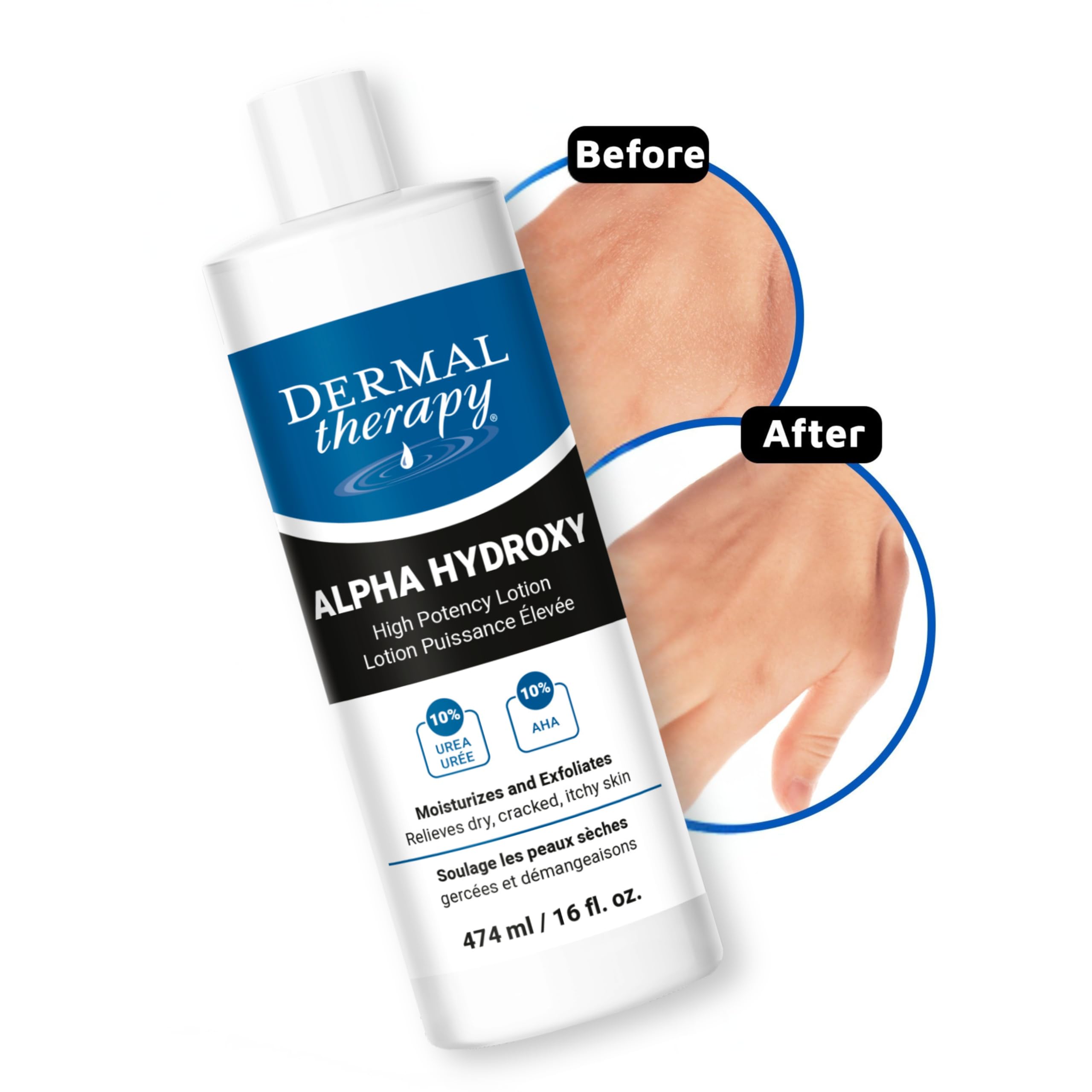 Dermal Therapy Alpha Hydroxy Lotion absorbs quickly after application on skin