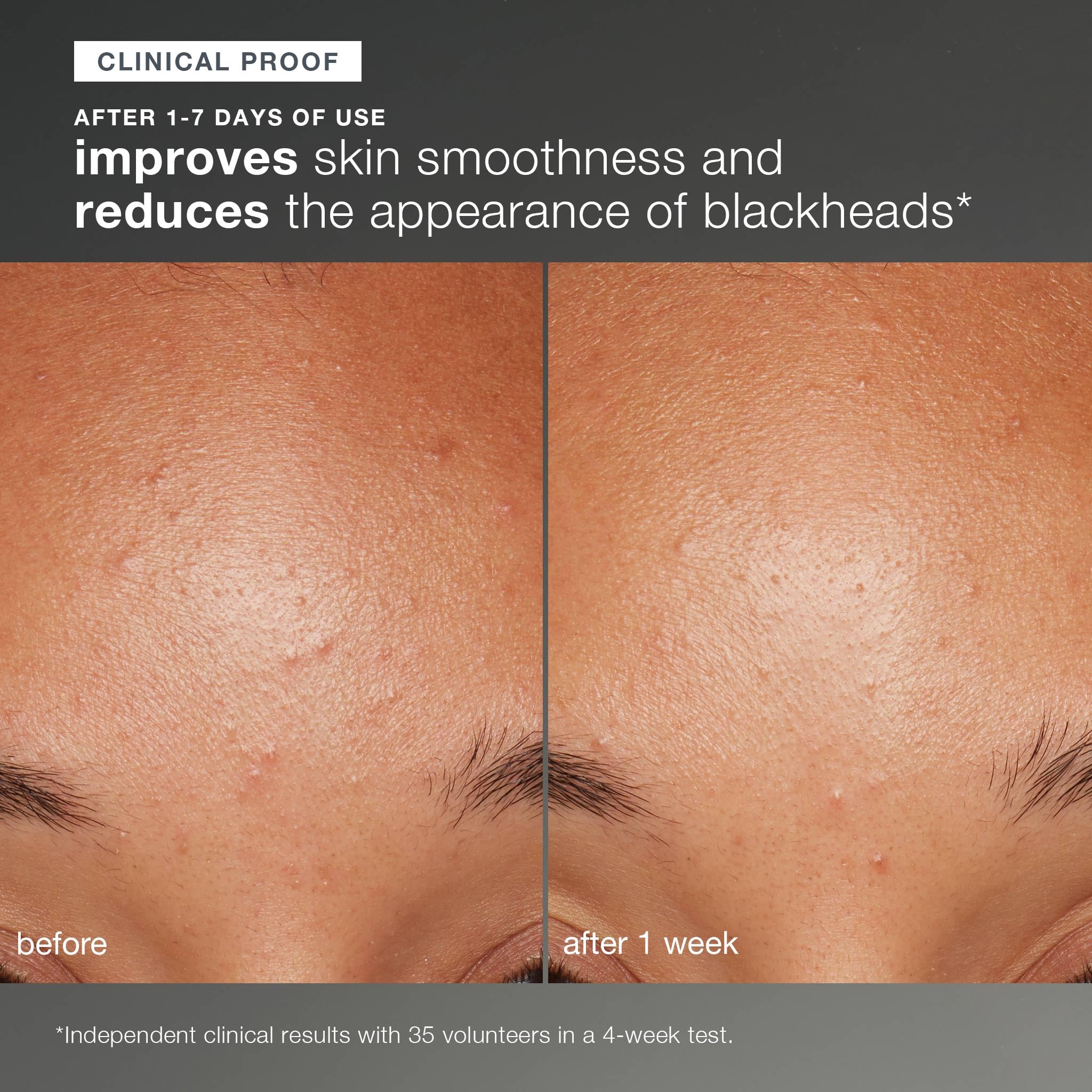 Dermalogica Daily Microfoliant creamy-paste-application delivers smooth texture and even tone with regular use.