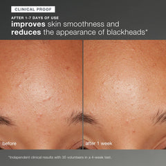 Dermalogica Daily Microfoliant creamy-paste-application delivers smooth texture and even tone with regular use.