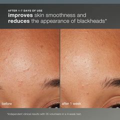 Dermalogica Daily Microfoliant applying to face for smoother skin after massage.