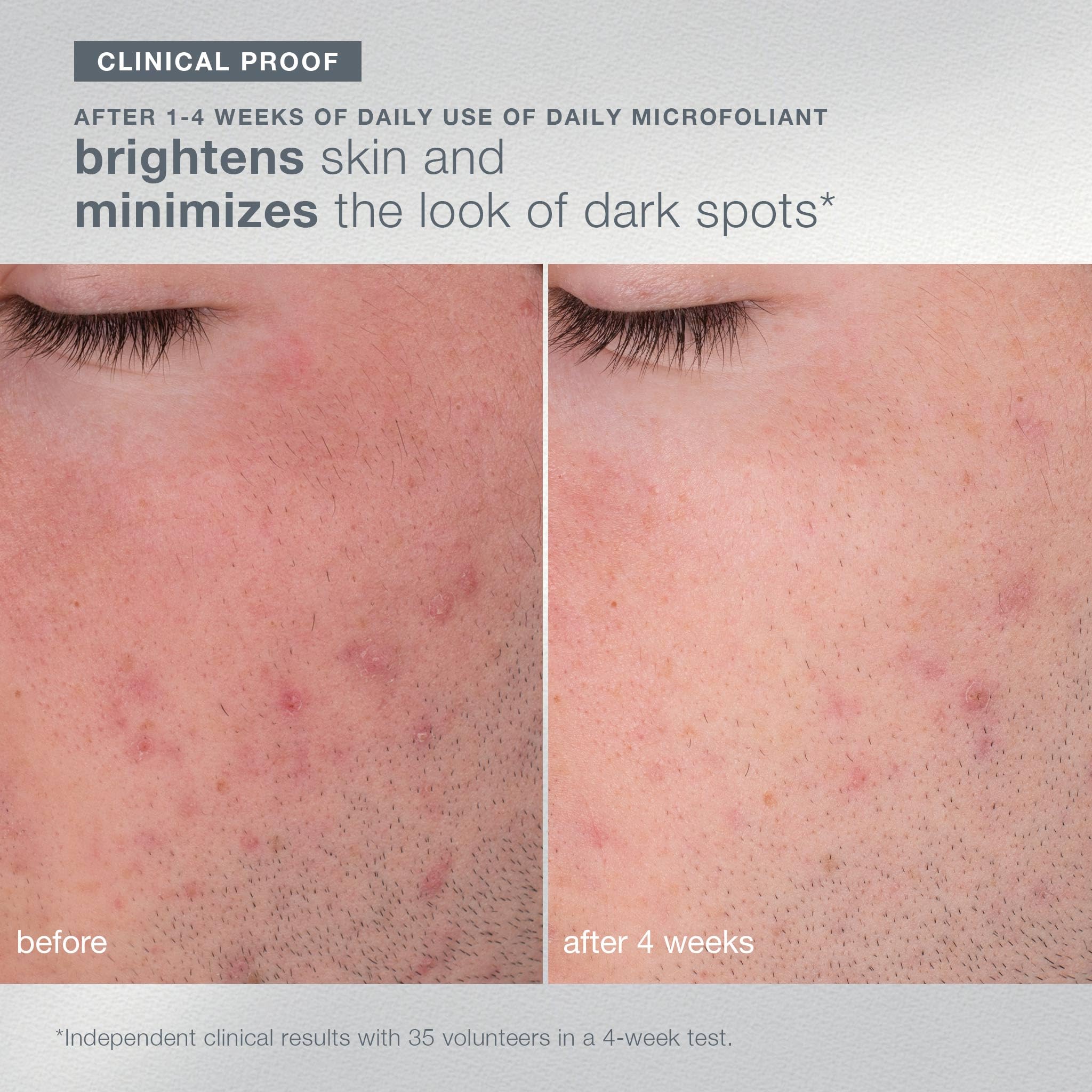 Dermalogica Let It Glow radiant-skin application image highlighting luminous results