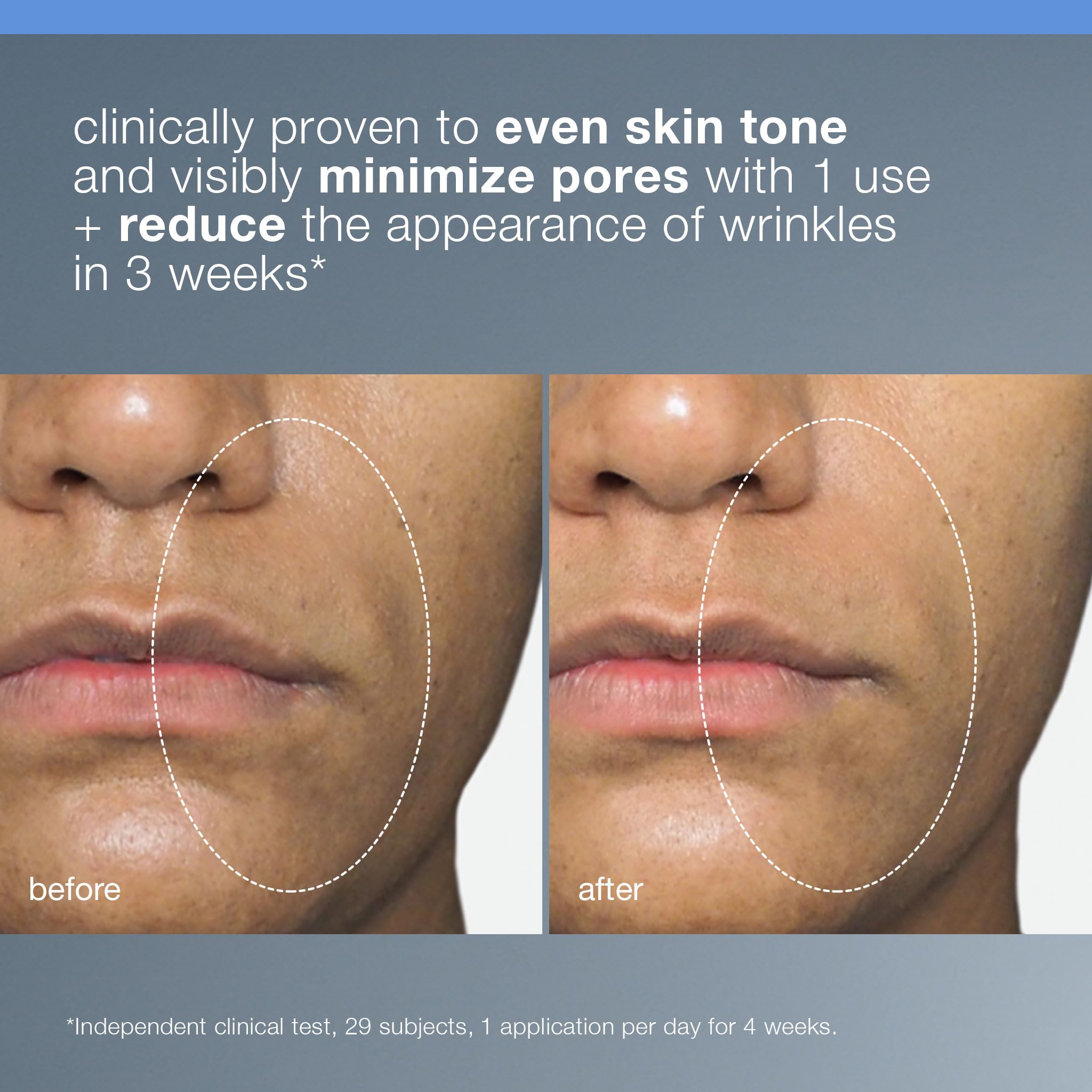Dermalogica Liquid Peelfoliant pore-detox close-up shows oil control