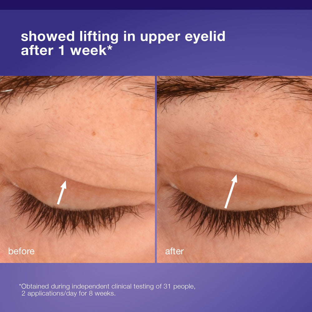 Dermalogica Phyto Nature eye-area closeup hints at a lifted appearance over time.