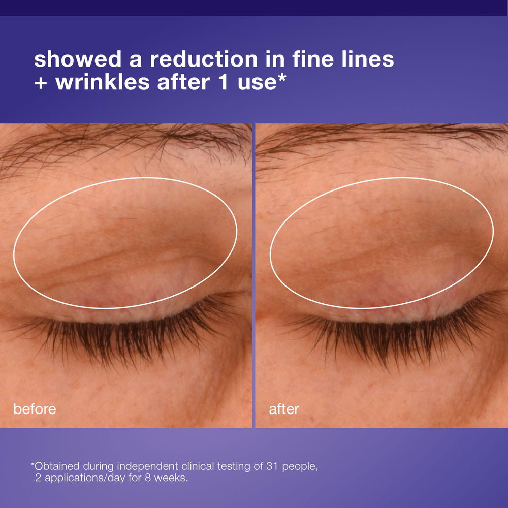 Dermalogica Phyto Nature rich-cream texture shown for redensified eye contour.