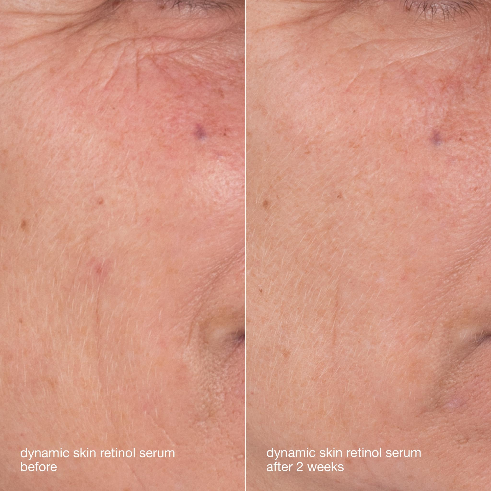 Dermalogica Skin Aging Solutions Kit daily routine guide showing simple steps.