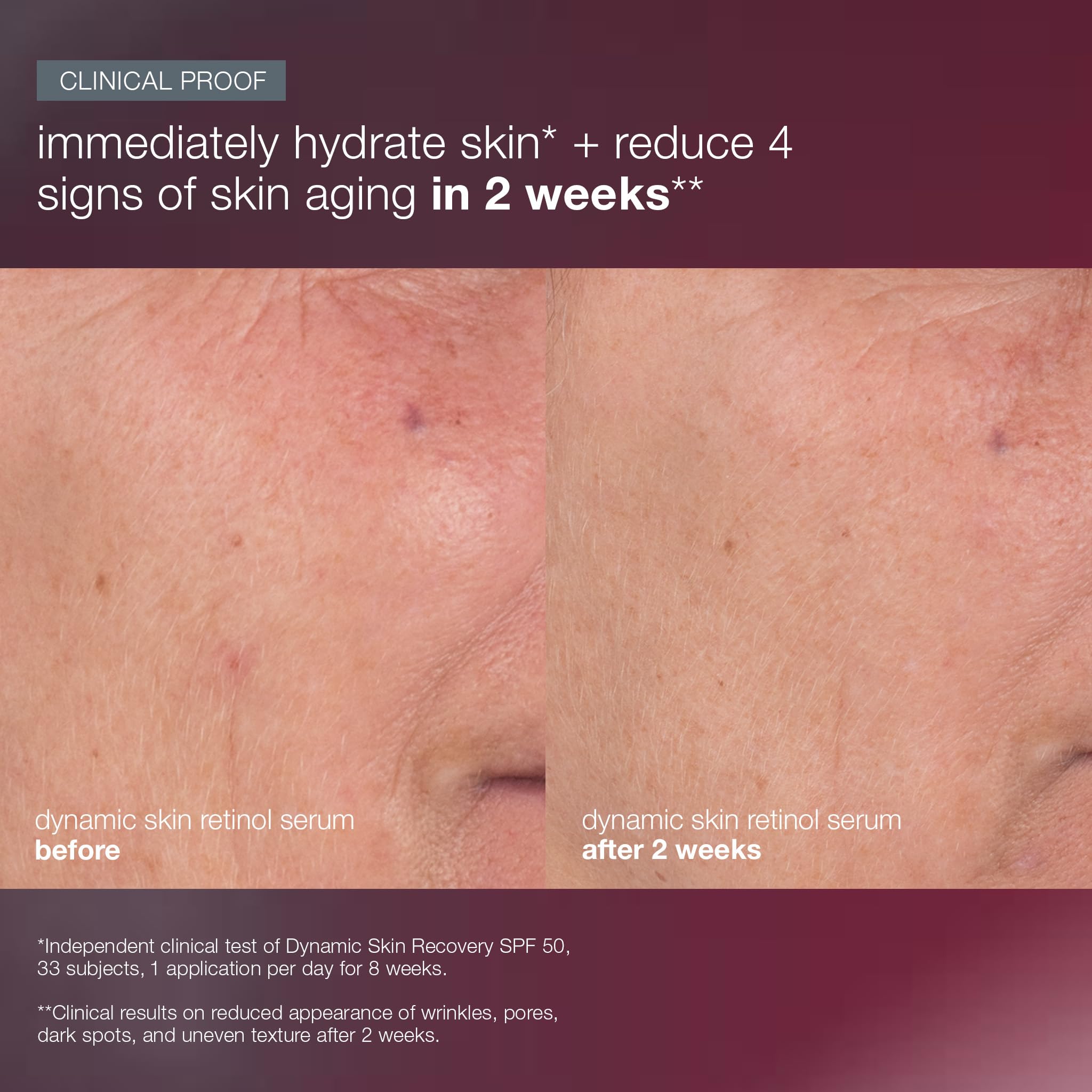 Dermalogica Skin Aging Solutions Kit closeup image of skin before application and after routine.