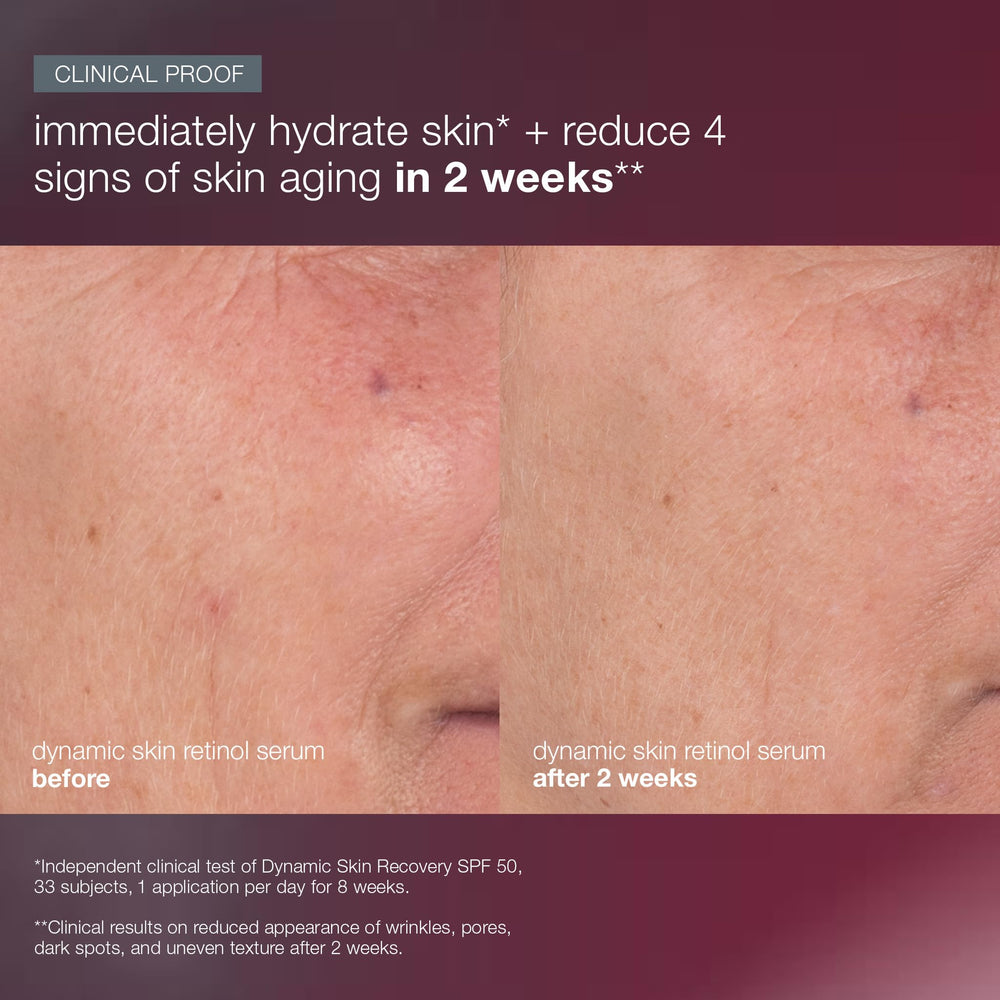 Dermalogica Skin Aging Solutions Kit closeup image of skin before application and after routine.