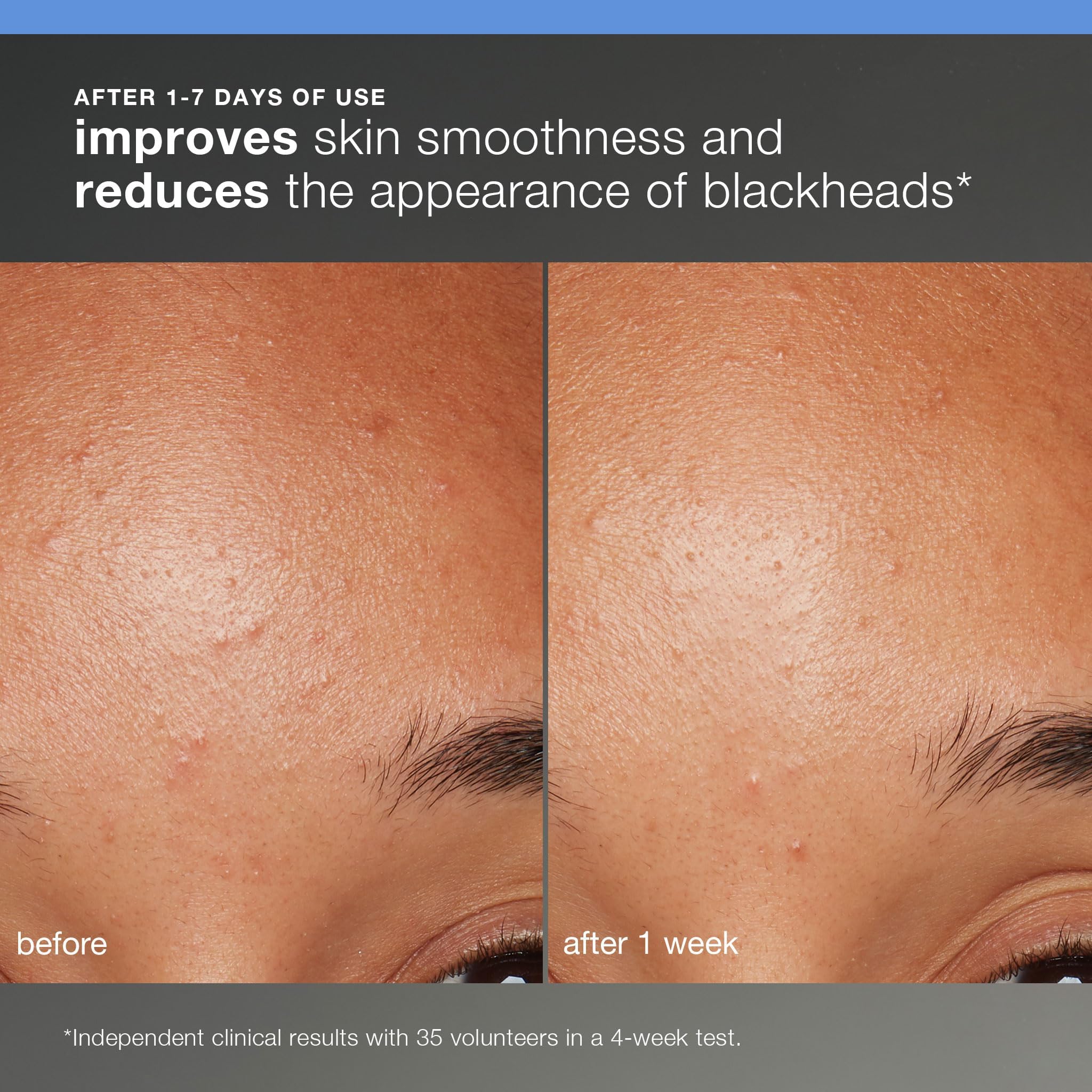 Dermalogica Skin Smoothing Cream jar provides hydrating finish for soft skin