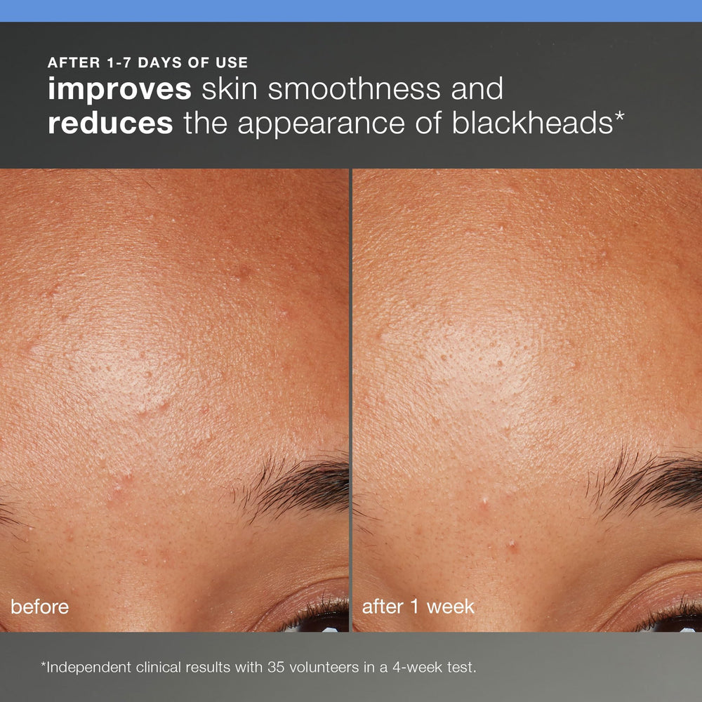 Dermalogica Skin Smoothing Cream jar provides hydrating finish for soft skin