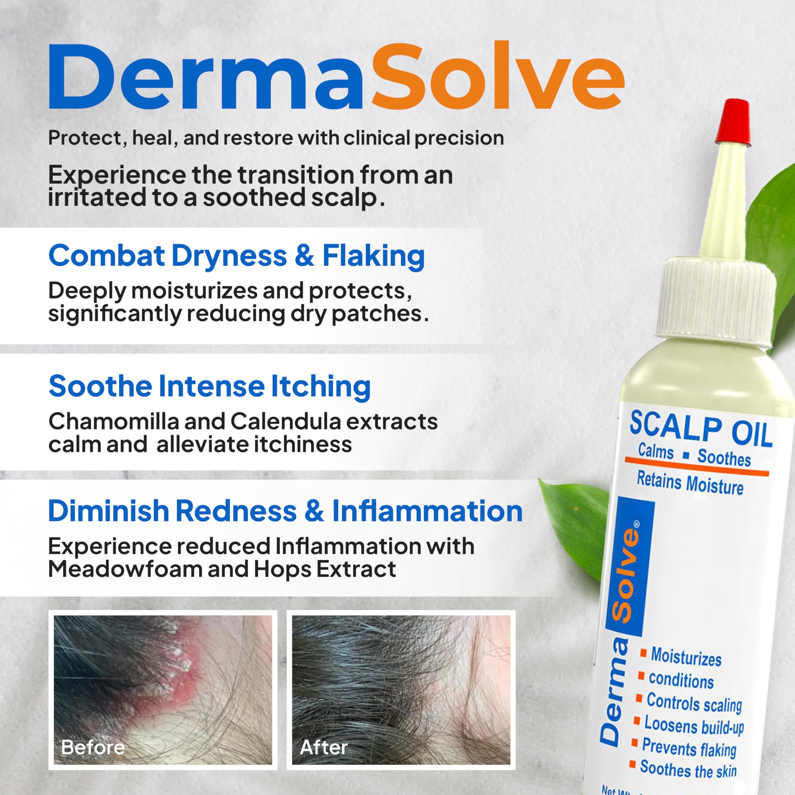 Dermasolve scalp oil dropper demonstrates precise application for targeted relief