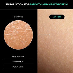 Dermasuri back-scrubber in shower for spa-like exfoliation at home