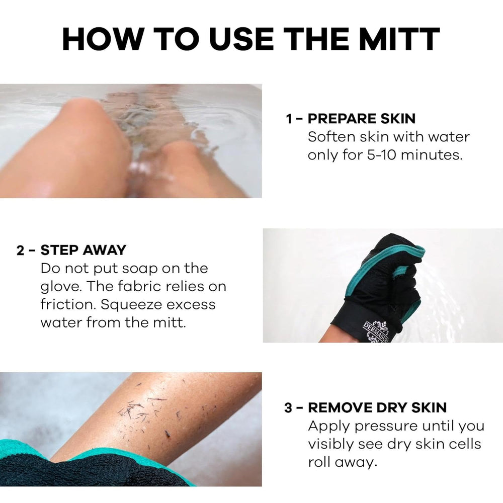 Dermasuri exfoliating mitt helps with keratosis pilaris texture over time