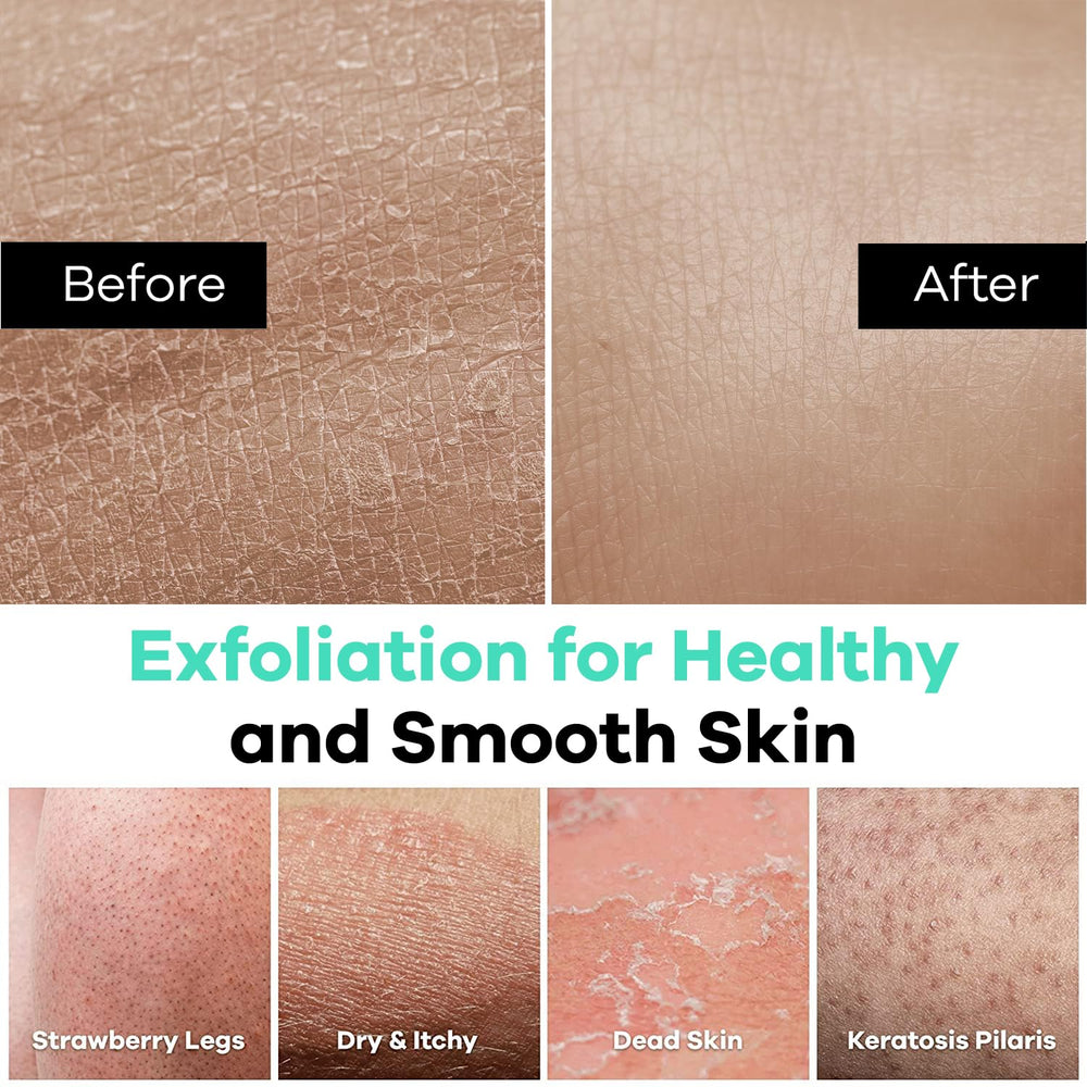 Dermasuri glove targets rough patches on elbows and knees for even texture