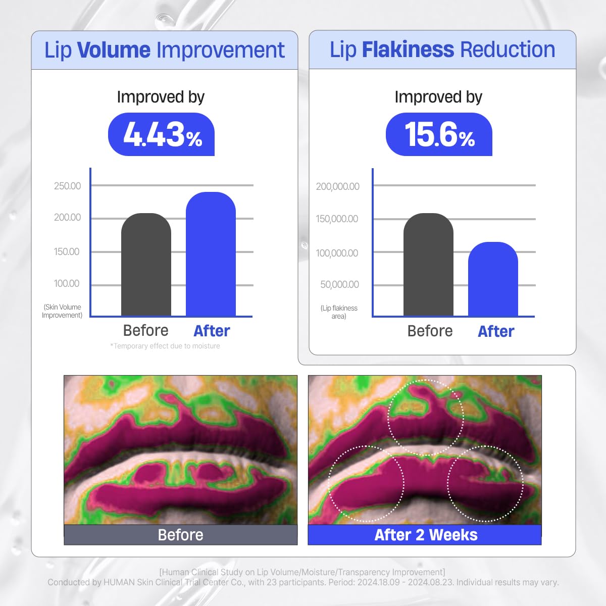 DERMATORY Lip Mask application on lips shows a radiant, glossy finish.
