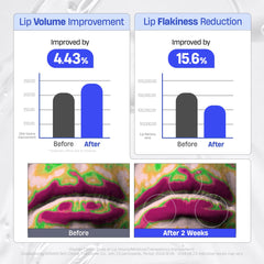 DERMATORY Lip Mask application on lips shows a radiant, glossy finish.