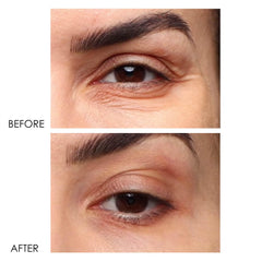 Dermelect Revitalite cool-tip-applicator enables precise, refreshing eye-area application