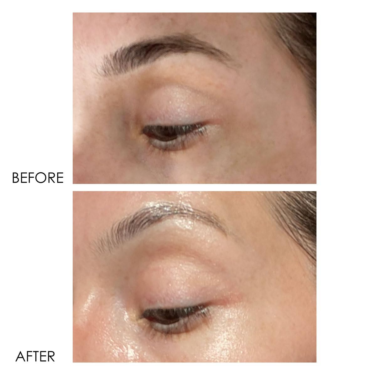 Dermelect Revitalite eye-area-closeup shows smoothing texture around eyelids
