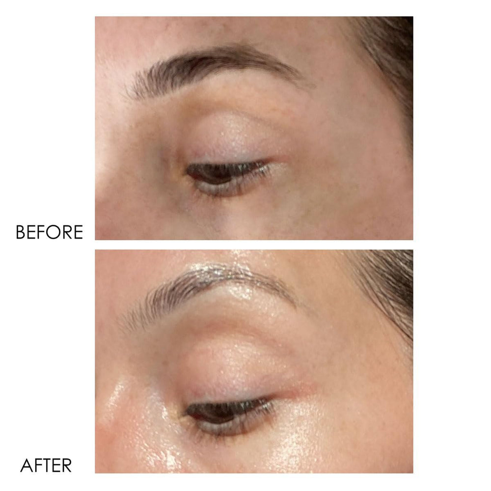 Dermelect Revitalite eye-area-closeup shows smoothing texture around eyelids