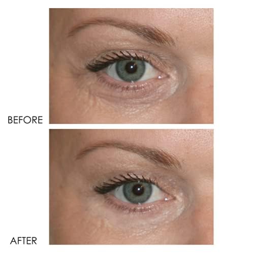 Dermelect Revitalite fine-lines-appearance image highlights potential wrinkle reduction near the eye