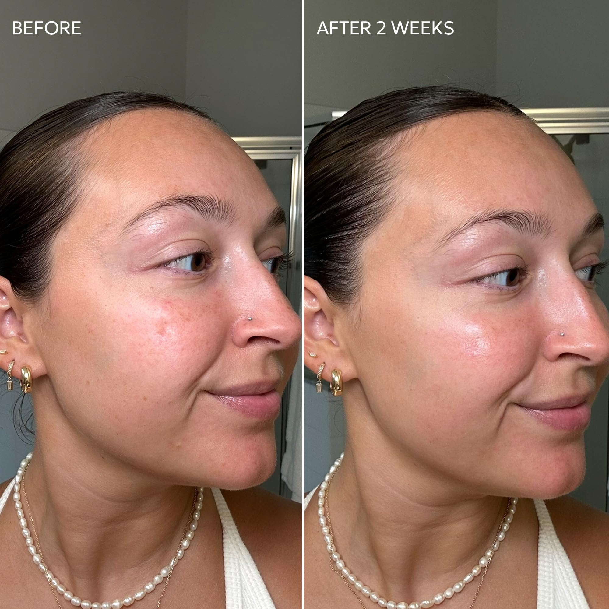 Dermisa Skin Fade Cream daily-use application promotes smoother, brighter-looking skin.