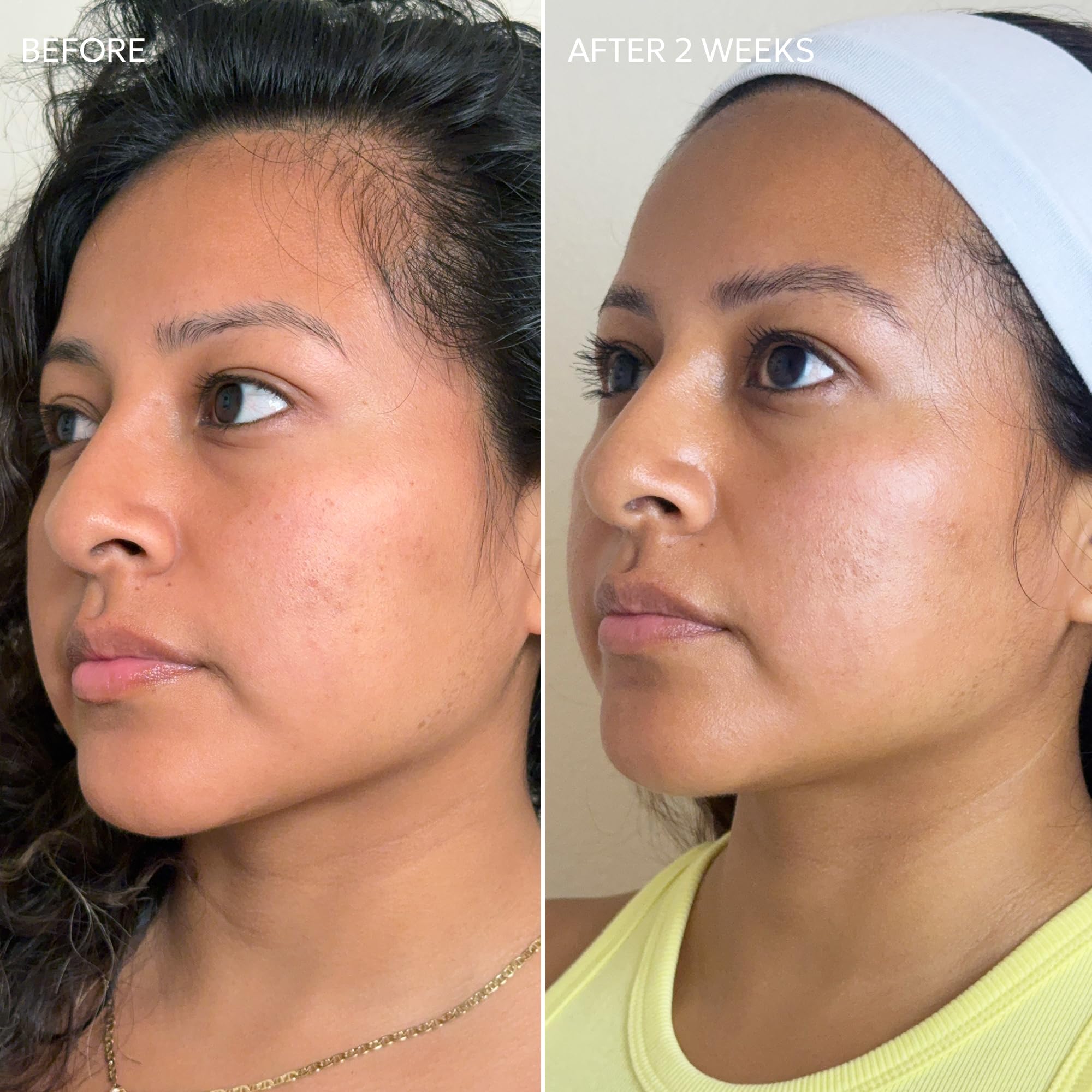 Dermisa Skin Fade Cream label details guide clean, paraben-free formulation.
