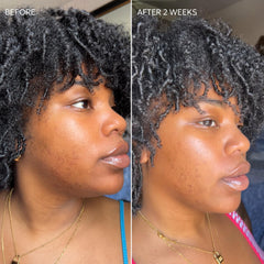 Dermisa Skin Fade Cream quick absorption texture ready for daily use.