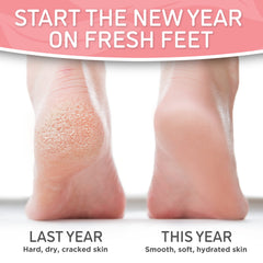 Dermora Soft Touch Foot Peel Mask packaging indicates 7–14 day softening progress
