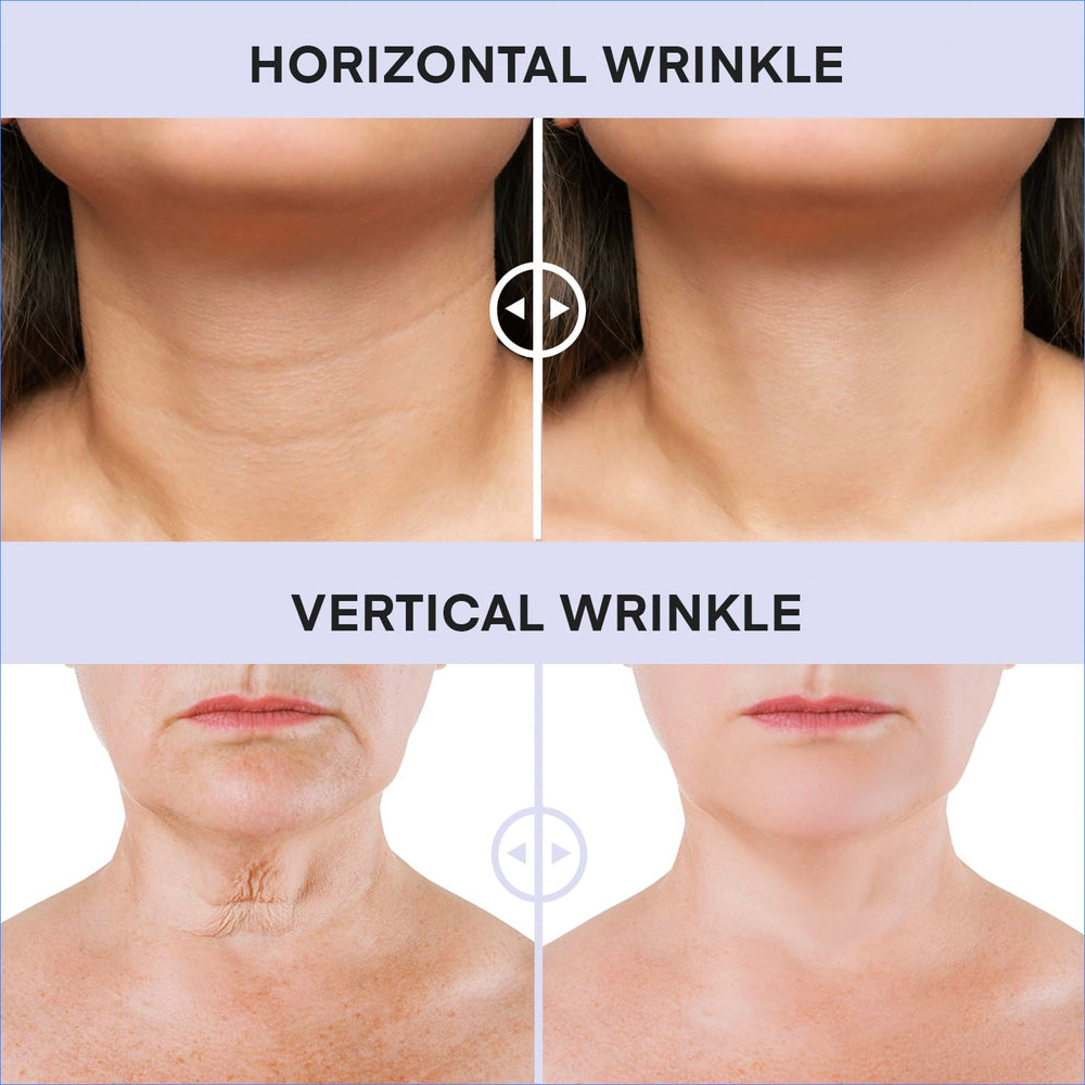 DERPHEA Neck Cream consistency demonstrates rich formula ready for nightly use.