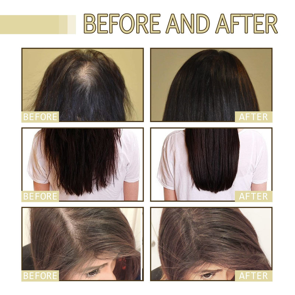 Deuiosna Carvenchi illustration hints at thicker-looking hair over time.