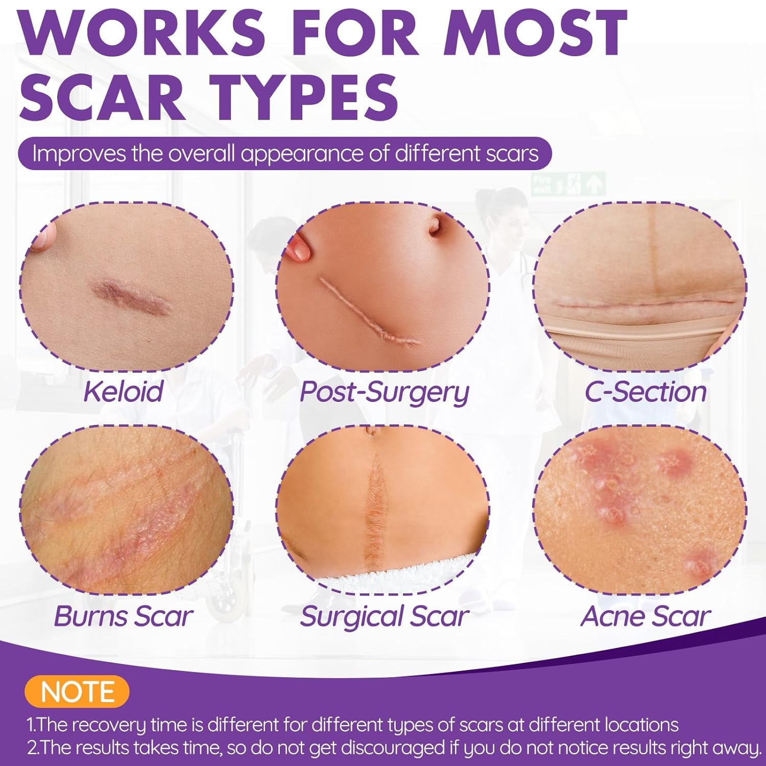 DFK silicone scar tape soft texture close-up.