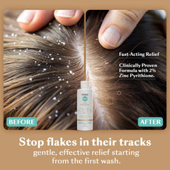 DHS Zinc Shampoo lather demonstrates gentle cleansing for flaky scalp after use.