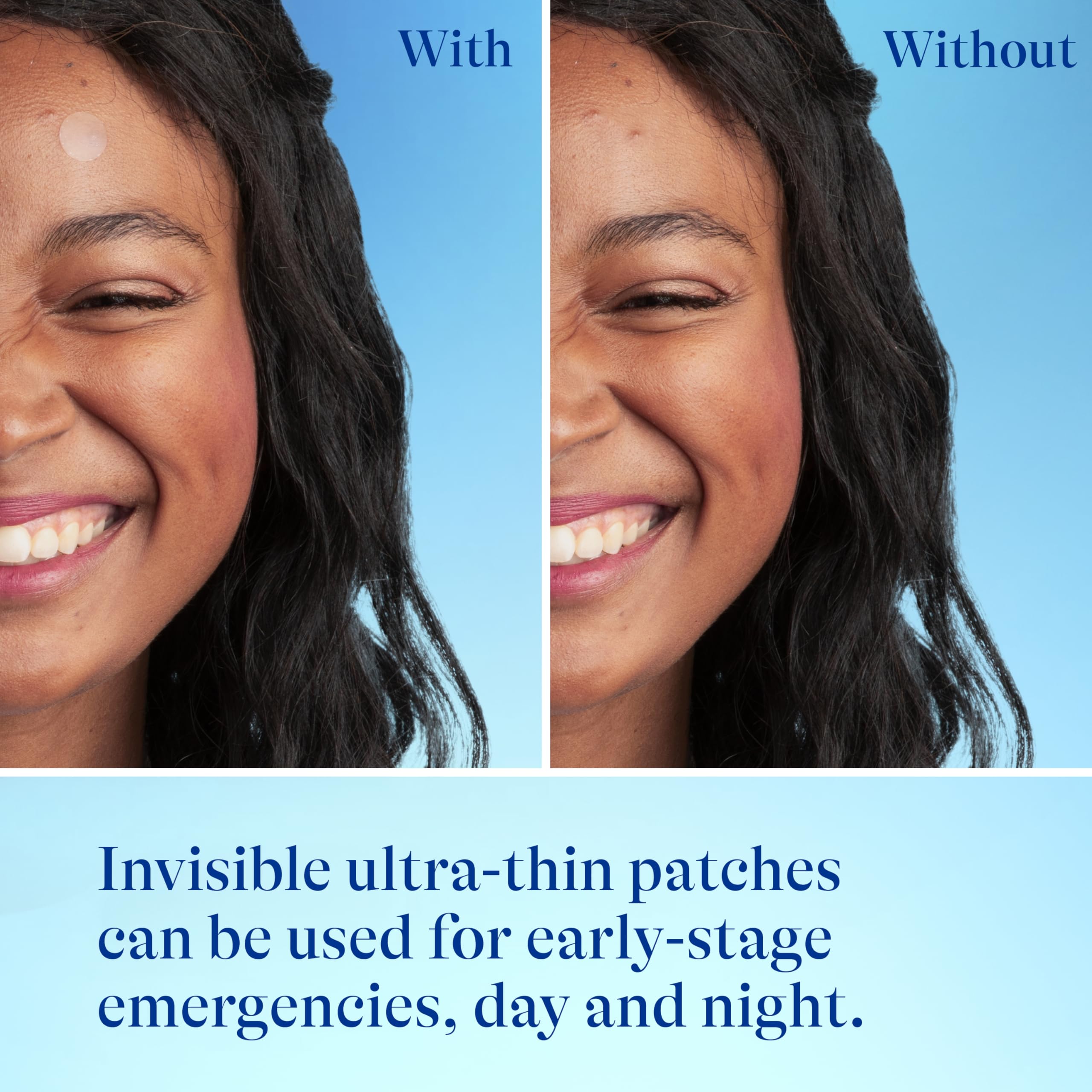 Differin patch featuring centella soothing effect around pimples.