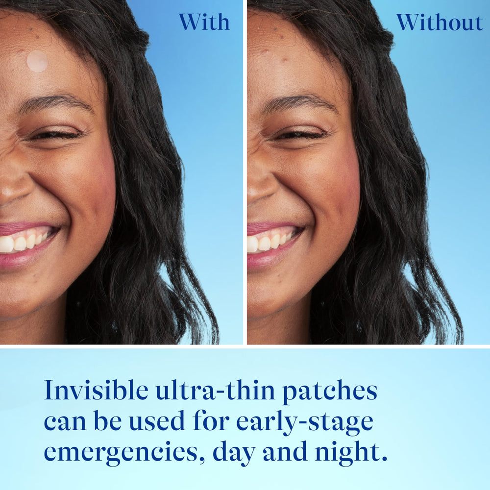 Differin patch featuring centella soothing effect around pimples.