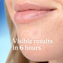 Differin patches in small and large sizes for blemish targeting.